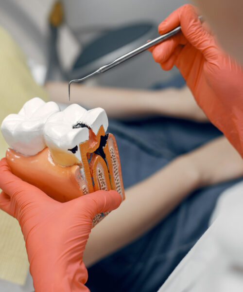 Remedii naturale pentru combaterea cariilor