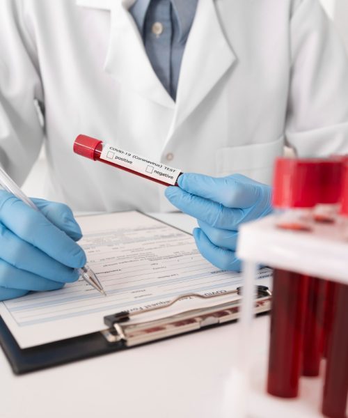 Analizele de Sânge Importante: Ghidul Diagnosticului și Monitorizării Sănătății