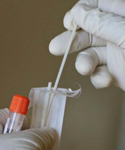 Testarea afecţiunilor contagioase: testele pe care orice clinică trebuie să le aibă în oferta sa