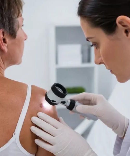 Tumori cutanate: cum le recunoști, când este necesară evaluarea medicală și ce opțiuni de tratament există